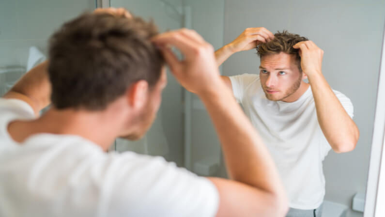 man with oily scalp